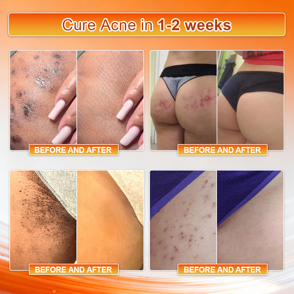 👙𝐎𝐟𝐟𝐢𝐜𝐢𝐚𝐥 𝐁𝐫𝐚𝐧𝐝 𝐒𝐭𝐨𝐫𝐞 | Von𝐮𝐭𝐫𝐢® 𝟐𝟎𝟐𝟔 𝐌𝐨𝐫𝐢𝐧𝐠𝐚 & 𝐁𝐞𝐫𝐛𝐞𝐫𝐢𝐧𝐞 𝟒-𝐈𝐧-𝟏 𝐌𝐢𝐜𝐫𝐨-𝐏𝐚𝐫𝐭𝐢𝐜𝐥𝐞 𝐒𝐜𝐮𝐥𝐩𝐭𝐢𝐧𝐠 & 𝐅𝐚𝐭-𝐁𝐮𝐫𝐧 𝐒𝐡𝐨𝐫𝐭𝐬
