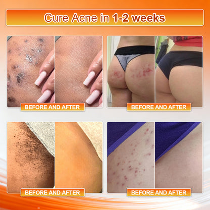 👙𝐎𝐟𝐟𝐢𝐜𝐢𝐚𝐥 𝐁𝐫𝐚𝐧𝐝 𝐒𝐭𝐨𝐫𝐞 | Von𝐮𝐭𝐫𝐢® 𝟐𝟎𝟐𝟔 𝐌𝐨𝐫𝐢𝐧𝐠𝐚 & 𝐁𝐞𝐫𝐛𝐞𝐫𝐢𝐧𝐞 𝟒-𝐈𝐧-𝟏 𝐌𝐢𝐜𝐫𝐨-𝐏𝐚𝐫𝐭𝐢𝐜𝐥𝐞 𝐒𝐜𝐮𝐥𝐩𝐭𝐢𝐧𝐠 & 𝐅𝐚𝐭-𝐁𝐮𝐫𝐧 𝐒𝐡𝐨𝐫𝐭𝐬