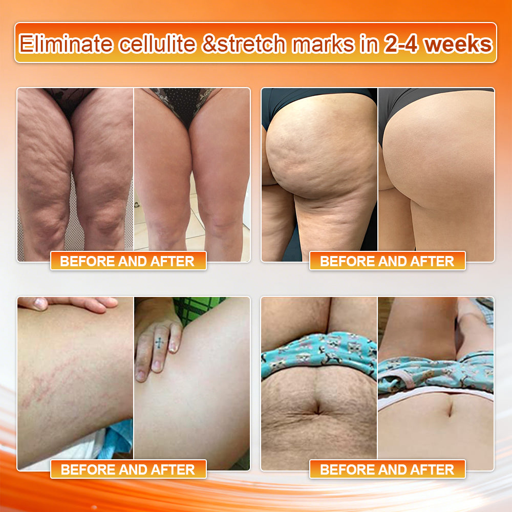 👙𝐎𝐟𝐟𝐢𝐜𝐢𝐚𝐥 𝐁𝐫𝐚𝐧𝐝 𝐒𝐭𝐨𝐫𝐞 | Von𝐮𝐭𝐫𝐢® 𝟐𝟎𝟐𝟔 𝐌𝐨𝐫𝐢𝐧𝐠𝐚 & 𝐁𝐞𝐫𝐛𝐞𝐫𝐢𝐧𝐞 𝟒-𝐈𝐧-𝟏 𝐌𝐢𝐜𝐫𝐨-𝐏𝐚𝐫𝐭𝐢𝐜𝐥𝐞 𝐒𝐜𝐮𝐥𝐩𝐭𝐢𝐧𝐠 & 𝐅𝐚𝐭-𝐁𝐮𝐫𝐧 𝐒𝐡𝐨𝐫𝐭𝐬