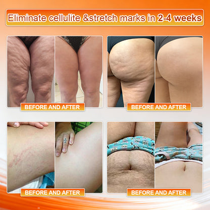 👙𝐎𝐟𝐟𝐢𝐜𝐢𝐚𝐥 𝐁𝐫𝐚𝐧𝐝 𝐒𝐭𝐨𝐫𝐞 | Von𝐮𝐭𝐫𝐢® 𝟐𝟎𝟐𝟔 𝐌𝐨𝐫𝐢𝐧𝐠𝐚 & 𝐁𝐞𝐫𝐛𝐞𝐫𝐢𝐧𝐞 𝟒-𝐈𝐧-𝟏 𝐌𝐢𝐜𝐫𝐨-𝐏𝐚𝐫𝐭𝐢𝐜𝐥𝐞 𝐒𝐜𝐮𝐥𝐩𝐭𝐢𝐧𝐠 & 𝐅𝐚𝐭-𝐁𝐮𝐫𝐧 𝐒𝐡𝐨𝐫𝐭𝐬